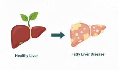 Fatty Liver Disease (ফ্যাটি লিভার)