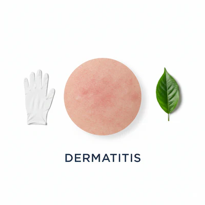 Dermatitis (চর্মরোগ)